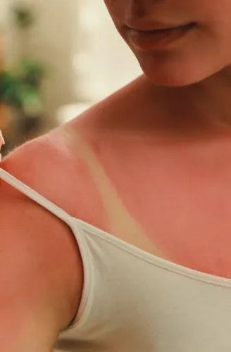 Total Block Gel Hidratante Reparador Post-Solar